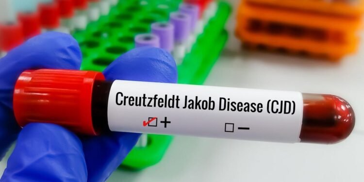 Lito Souza, influenciador digital diagnosticado com a DCJ
